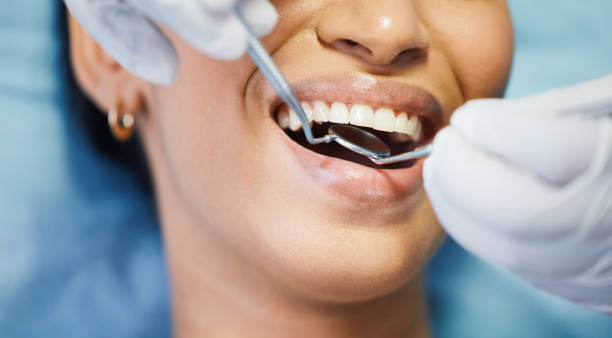 Best Emergency Cosmetic Dentistry in Summerside, OH