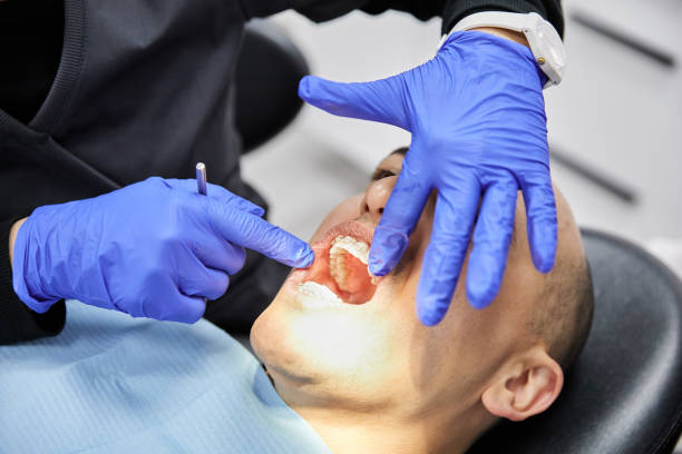 Best Emergency Dentist for Lost Fillings or Crowns in Summerside, OH